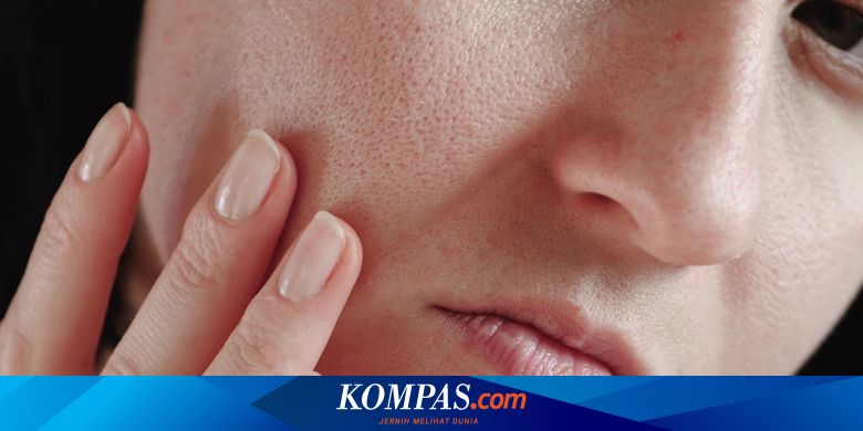 Mitos Dan Fakta Seputar Pori Pori Di Wajah Yang Perlu Anda Tahu Halaman All Kompas Com