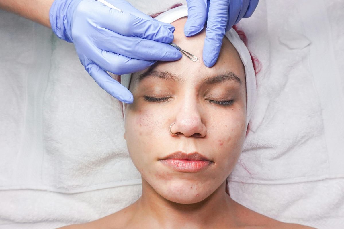 Urutan skincare untuk menghilangkan bekas jerawat.