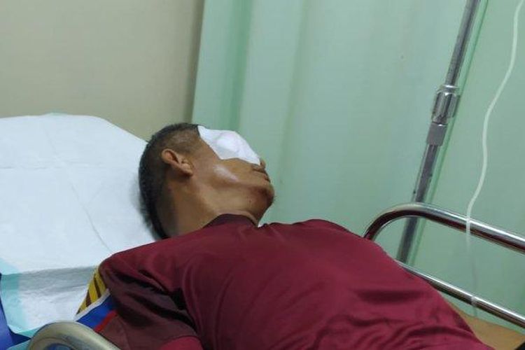 Zaharman (58) Guru SMAN di Rejang Lebong korban penganiayaan saat mendapat perawatan intensif di Rumah Sakit Ar Bunda Kota Lubuklinggau usai diketapel wali murid, Selasa (1/8/2023).

