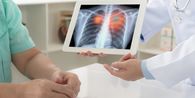 Jenis Skrining Kanker yang Direkomendasikan Dokter