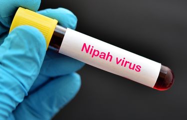 Ilustrasi virus nipah. Kasusnya belum ada di Indonesia, tetapi Kementerian Kesehatan menghimbau peningkatan kewaspadaan. 