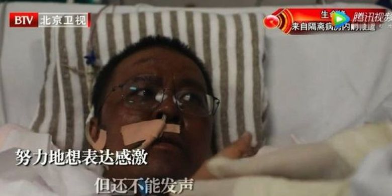 Dr Hu Weifeng, dokter di Wuhan yang menjadi viral pada April setelah kulitnya menghitam dikarenakan pengobatan virus corona. Dia meninggal pada Selasa (2/6/2020) setelah lima bulan berjuang.