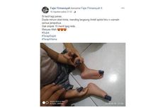 Viral, Foto Jempol Anak Kecil Diwarnai untuk Turunkan Demam Tubuh