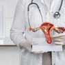 Gaya Hidup Tidak Sehat Tingkatkan Risiko Kanker Endometrium
