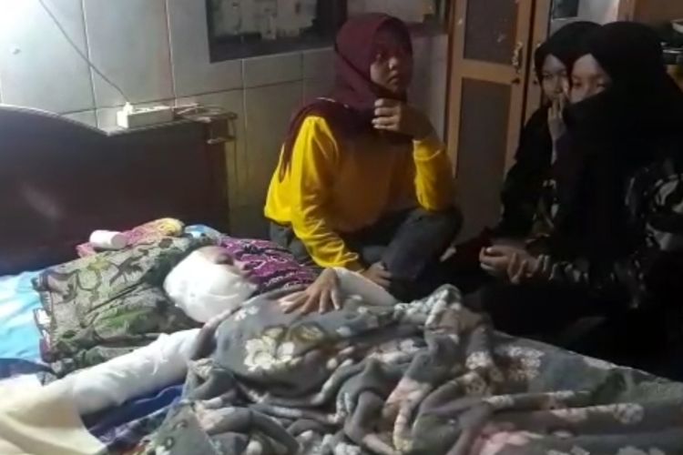 Siswi kelas 2 SMK di Brebes terbaring lemah di tempat tidurnya akibat menjadi korban penyiraman air keras, di rumahnya di Desa Sisalam, Wanasari, Brebes, Selasa (16/3/2021) (Istimewa)