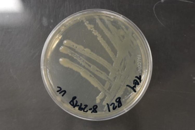 Pseudomonas putida, salah satu bakteri yang dapat mendegradasi minyak.