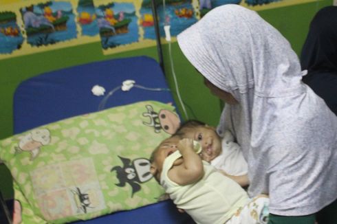 Sakit, Bayi Kembar Siam Fadli-Fadlan Dirujuk ke RSHS Bandung