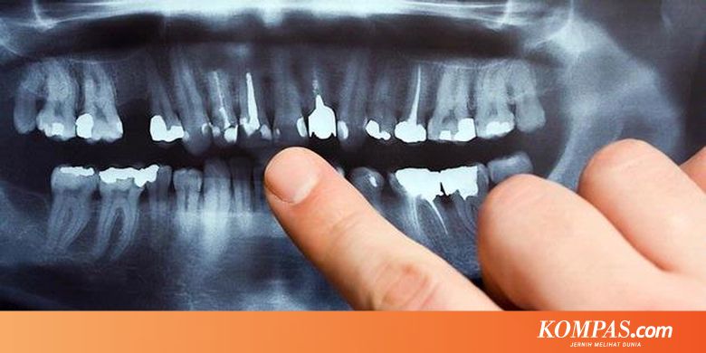 Biaya Ct Scan Kepala Di Pramita - ct scan machine