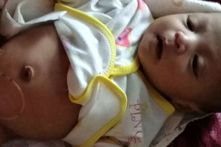  Perut bayi Arsyil (19 hari) yang terus membesar karena menampung air seni yang dia keluarkan. Daging tumbuh  didalam alat kelaminnya membuat bayi Arsyil tidak bisa buang air kecil, sehingga kedua ginjalnya terancam gagal ginjal karena terinveksi jika tidak segera dioperasi.