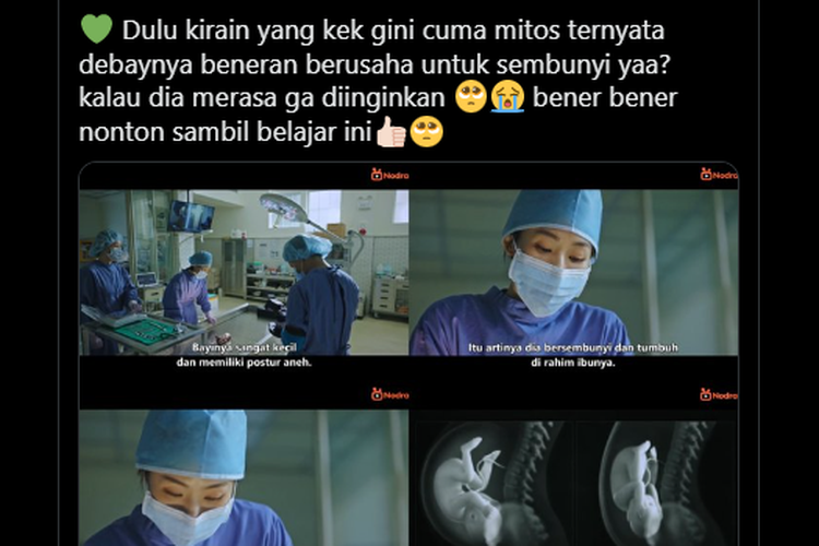 Ramai soal Unggahan Janin Bersembunyi Saat Kehamilan Tidak Diinginkan, Ini Kata Dokter