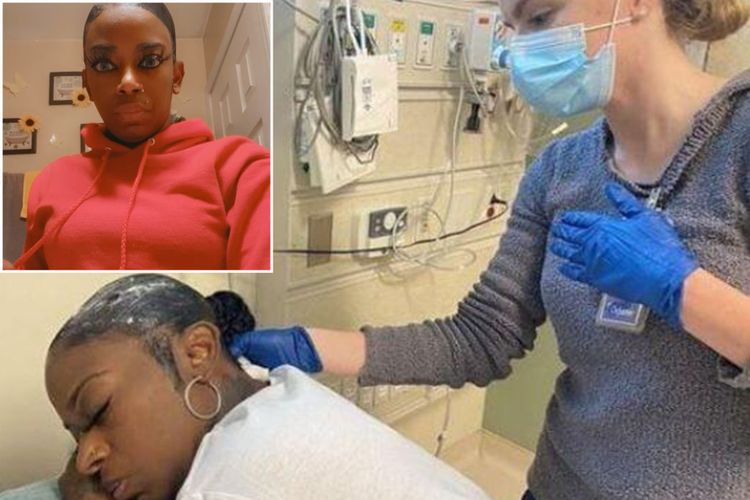 Wanita asal AS, Tessica Brown, akhirnya ke rumah sakit setelah menggunakan lem gorilla untuk rambutnya.