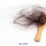 Cara Mengatasi Rambut Rontok pada Anak