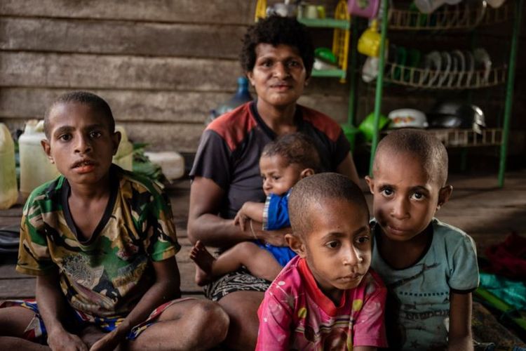 Kasparina Mahuze, 26 tahun bersama putra-putranya. Asadurus Basik-basik, putranya yang berkemeja merah muda, menderita gizi buruk. Mereka tinggal di Kabupaten Merauke, Papua.