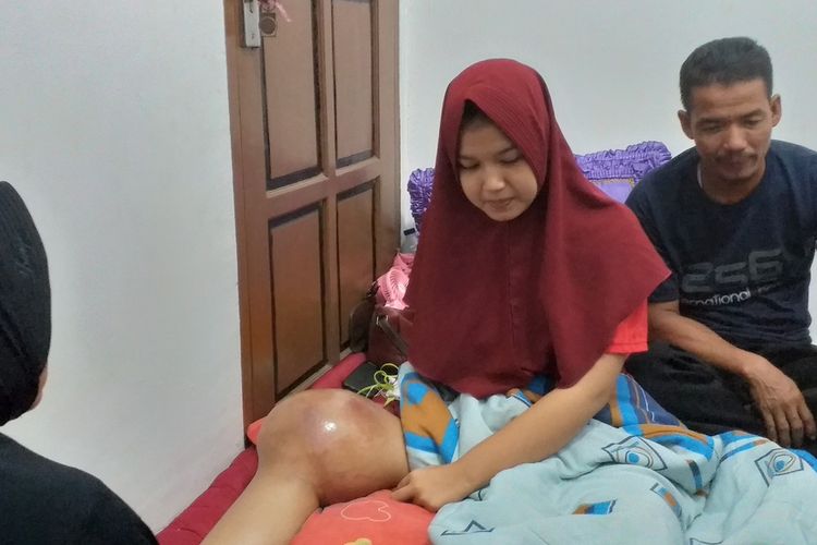 Riska Ramadila (17), siswi SMA yang mengidap penyakit tumor ganas saat berada di rumah pamannya di Desa Kubang Jaya, Kecamatan Siak Hulu, Kabupaten Kampar, Riau, Minggu (2/2/2020).