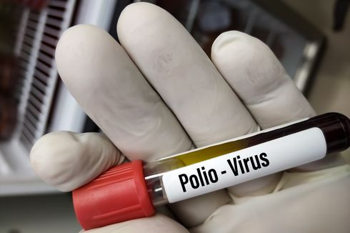 KLB Polio di Pamekasan, Feses 30 Balita Diuji Lab dan Hasilnya Negatif