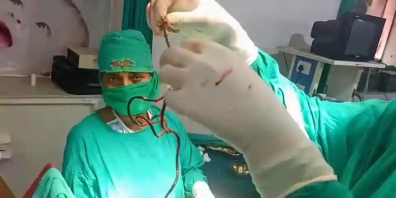 Operasi yang dilakukan Dr Sunil Kumar di India mengangkat dua kabel charger dari penis seorang pria. Pria itu disebut melakukannya karena depresi istrinya kawin lari.
