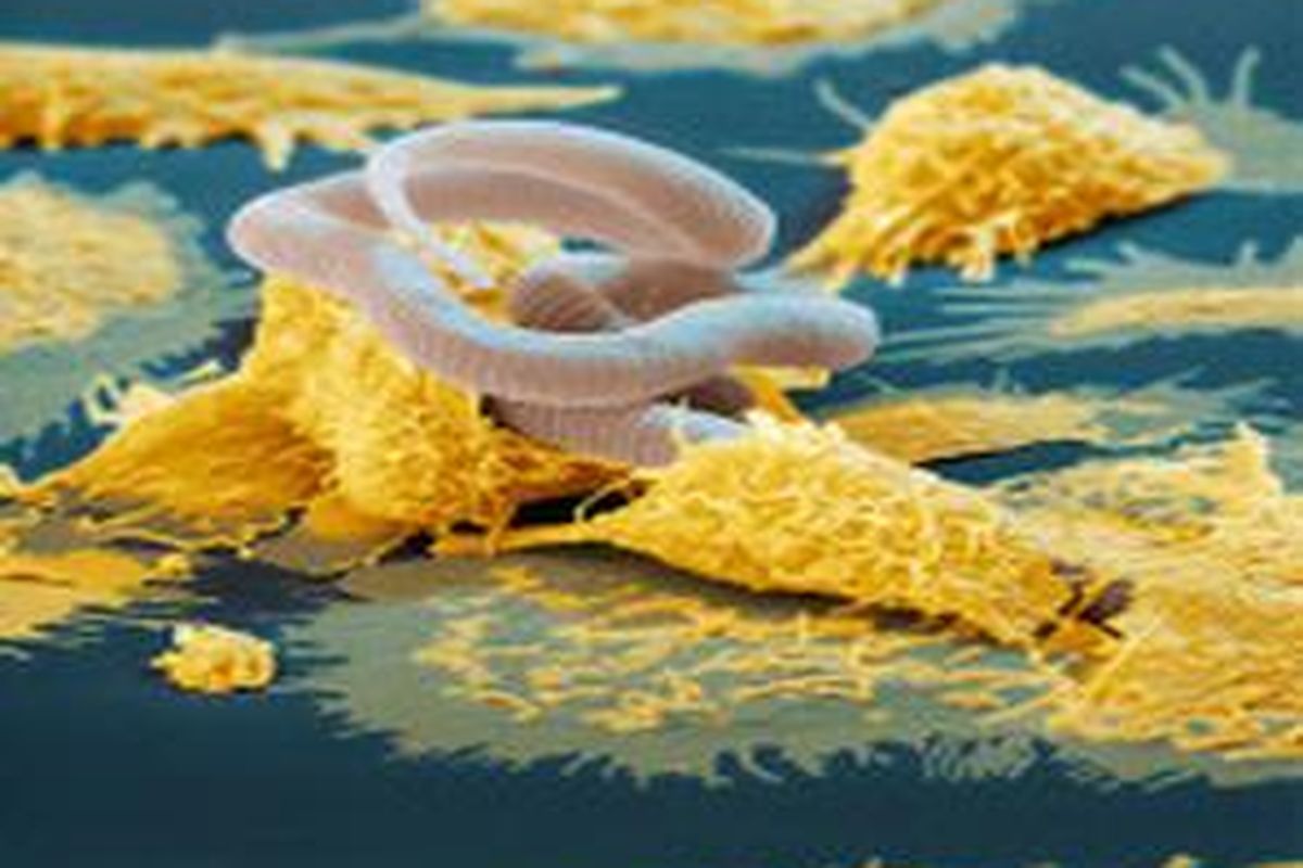 Makrofag (kuning) menyerang larva parasit cacing nematoda penyebab kaki gajah. 