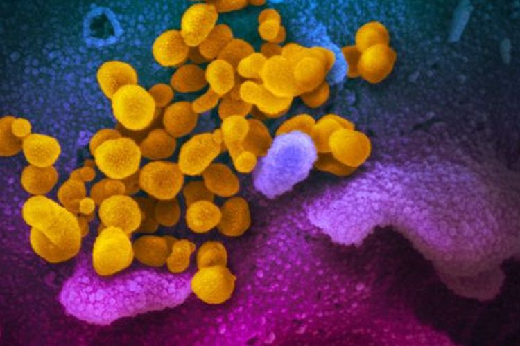 Gambar mikroskop elektron pemindai menunjukkan virus corona Wuhan atau Covid-19 (kuning) di antara sel manusia (biru, merah muda dan ungu). 