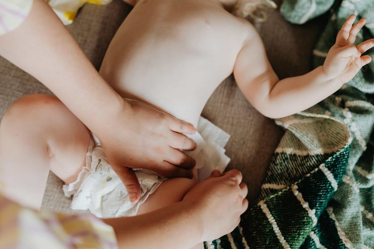 Memilih popok anak harus dilakukan dengan cermat karena salah pilih produk bisa menyebabkan ruam dan masalah kulit lainnya. 