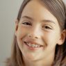 4 Tips Seputar Penggunaan Kawat Gigi ala Pakar UGM
