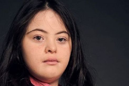 Gadis Penyandang Down Syndrome Ini Jadi Model Majalah Vogue