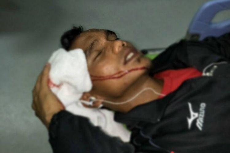 Pemain Semen Padang, Riko Simanjuntak, dilarikan ke rumah sakit setelah bus tim diserang oknum, Jumat (21/4/2017).