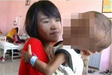 Sudah Alami Gizi Buruk, Anak Balita 1,5 Tahun Kerap Dipukuli Ayahnya