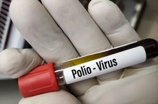 Kemenkes Temukan 3 Kasus Lumpuh Layu Akut Disebabkan Virus Polio Tipe 2