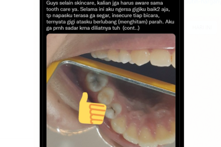 Tangkapan layar unggahan soal gigi hitam/gigi berlubang disebut bikin bau mulut.