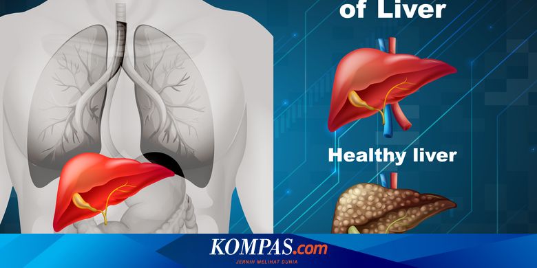 Mengenal Sirosis Hati, Penyebab, Gejala, dan Perawatannya