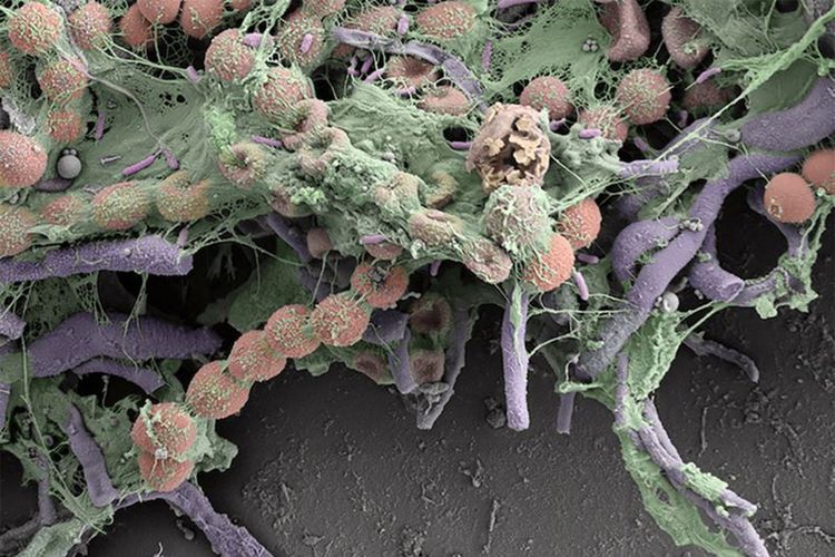 Foto mikroskopis dari mikroba di dalam bebek karet