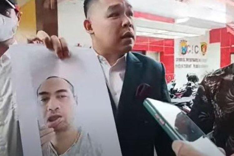 Ferry Irawan diperiksa sebagai tersangka kasus KDRT terhadap Venna Melinda di Polda Jatim. Ia membawa barang bukti berupa foto yang memperlihatkan bibirnya robek akibat dicakar. 