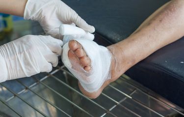 Kasus diabetes akut dapat menyebabkan kaki penderita terluka atau muncul borok sehingga harus diamputasi.