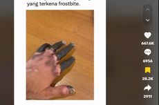 Viral Video Pendaki Gunung Alami Amputasi karena Frostbite, Apa Itu?