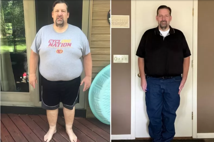Greg Wendel (51) sebelum dan sesudah mengalami penurunan berat badan sebanyak 42 kilogram dalam waktu delapan bulan. 