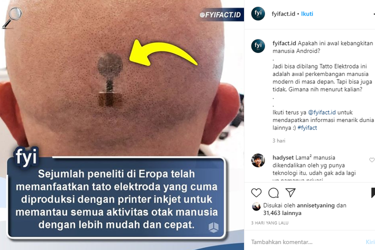 Tangkapan layar informasi tato elektroda oleh akun Instagram fyifact.id