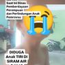 ASN Dinas Perlindungan Anak Siram Anak Tiri Pakai Air Panas, Suami Memaafkan