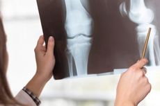 Cara Mencegah Osteoporosis Pada Usia Muda