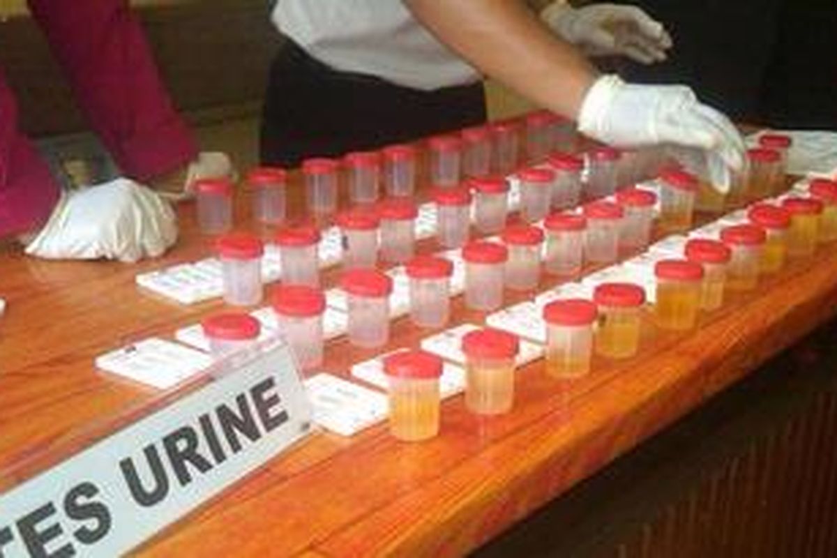 Botol tempat sample urin yang akan dilakukan pemeriksaan kandungan narkoba.