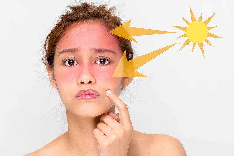 Alergi kulit bisa muncul karena kandungan bahan kimia kosmetik.