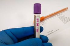 Mengenal Tes HPV DNA, Apa Manfaatnya?