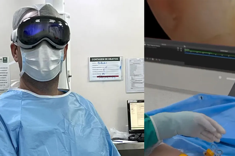 Seorang dokter ortopedi asal Brasil, Bruno Gobbato menggunakan headset AR Apple Vision Pro untuk membantu proses operasi rotator cuff.