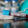 Lebih dari 5 Juta Kasus, Ilmuwan AS Peringatkan untuk Tidak Mengandalkan Vaksin Corona