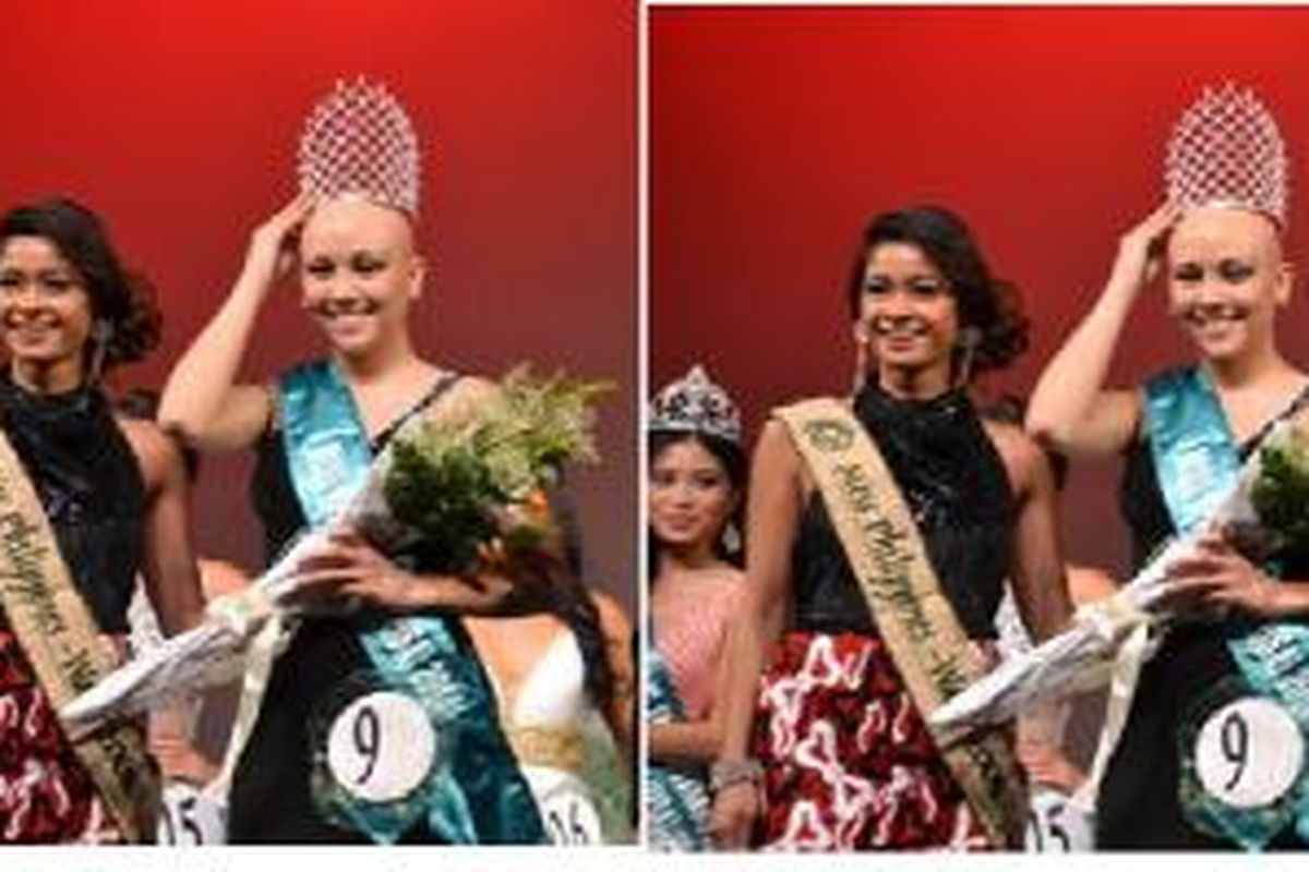 Angelica Galindez, 19 tahun memenangi Miss Philippines Earth USA, dengan rambut plontos. 