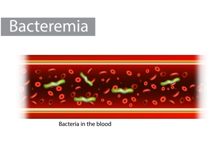 ilustrasi bakteremia