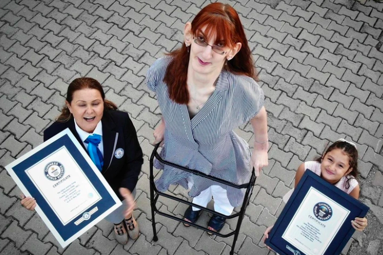 Rumeysa Gelgi ditetapkan sebagai wanita tertinggi di dunia oleh Guinness World Records