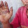 Buktikan Tak Bersetubuh dengan Seorang Perempuan, Sopir di Sikka Dipaksa Pegang Besi Panas, Ini Ceritanya