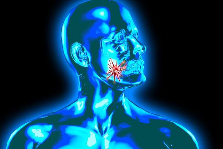 Ilustrasi kanker mulut