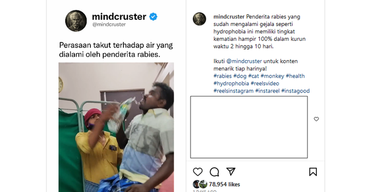 Modi Ki Xxx Vidio - Ramai soal Penderita Rabies Disebut Takut Air, Benarkah? Halaman all -  Kompas.com