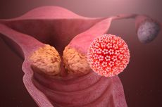 Apakah Infeksi HPV Bisa Disembuhkan? Simak Penjelasan Dokter Berikut…